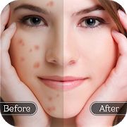 Скачать Средство для удаления пятен лица - гладкая кожа (Разблокированная) версия 1.4 apk на Андроид